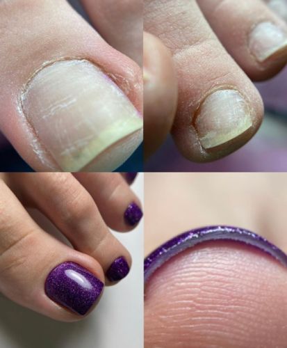 Культура педикюра. Эстетика. Тариф Без обратной связи (Анна Романова)