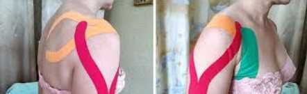 Динамическое тейпирование в практике мануальной терапии (Фидель Субботин)