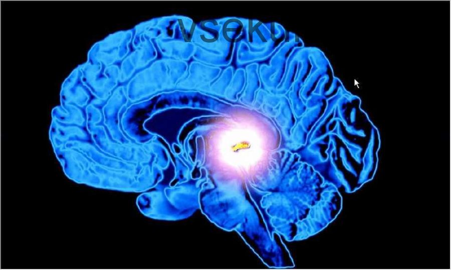 Как увеличить шишковидную железу и активировать «шишковидный портал» (Галина Эль - Шарас)