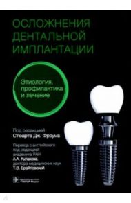 Осложнение дентальной имплантации. Этиология, профилактика и лечение / Фроум Стюарт Дж., Адольфи Дарио, Адольфи Маурицио  Контар