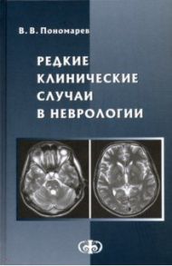 Редкие клинические случаи в неврологии (случаи из практики). Руководство для врачей / Пономарев Владимир Владимирович