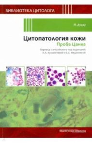 Цитопатология кожи. Проба Цанка / Дурду М.