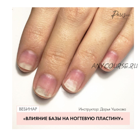 [parisnail] Влияние базы на ногтевую пластину (Ксения Ткачук)