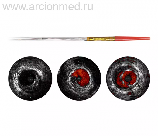 Цифровой катетер Philips Eagle Eye Platinum для внутрисосудистого ультразвукового исследования (ВСУЗИ)